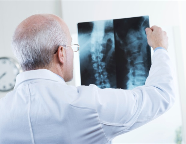 Revolutionizing Spine Surgery – AI Predicts Patient Recovery