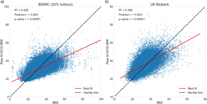 AI-ECG Predicts BMI and Cardiometabolic Disease Risk