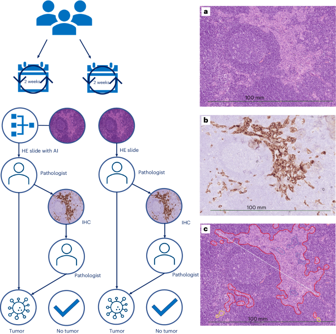 AI Assistance in Pathology Reduces Costs and Time