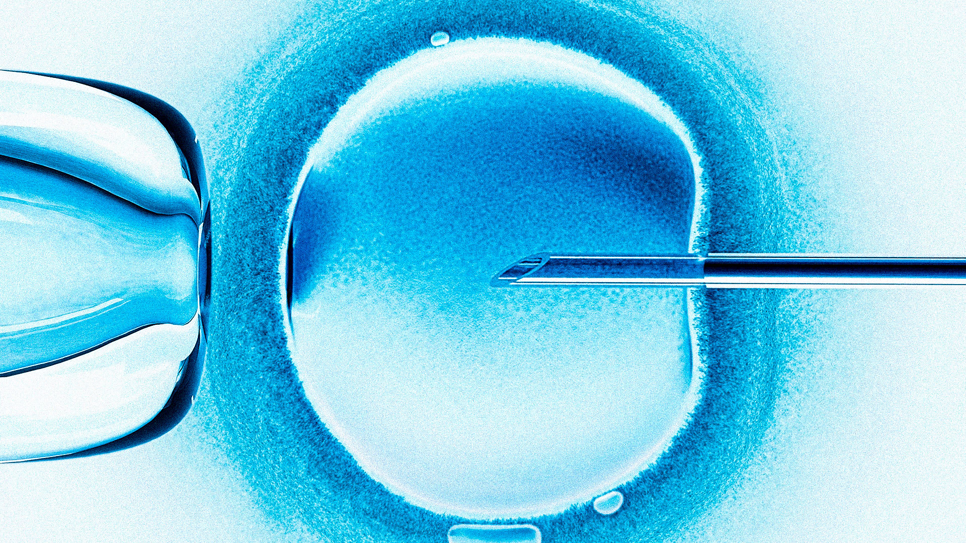 AI and Automation – The Future of IVF