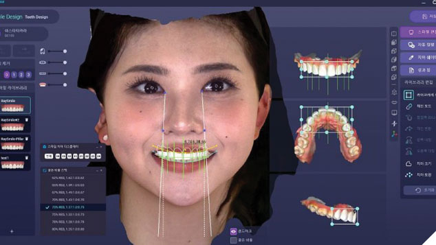 AI Revolutionizes Dentistry – From Diagnosis to Treatment