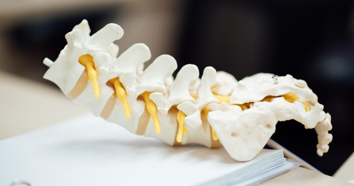 AI Slashes Lumbar Spine MRI Interpretation Time for Physicians