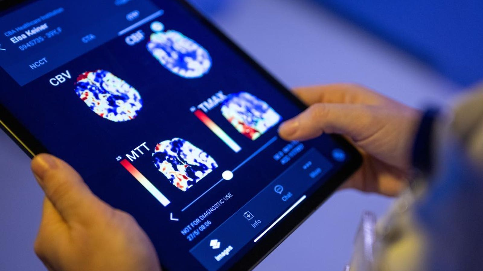 AI’s Growing Impact on Our Lives