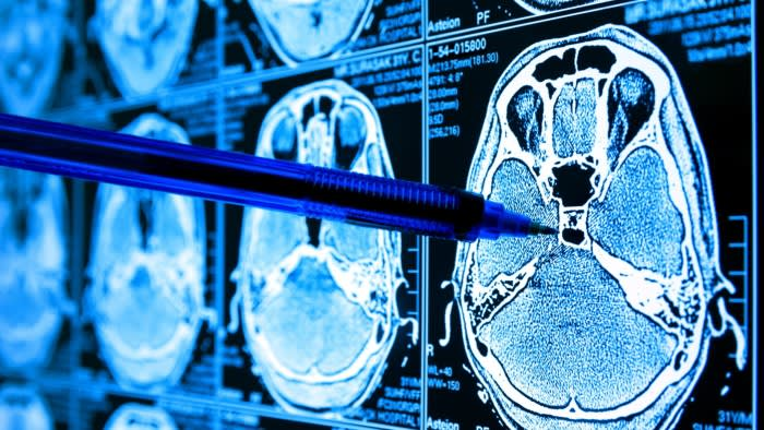 AI’s Role in Advancing Scientific Discovery