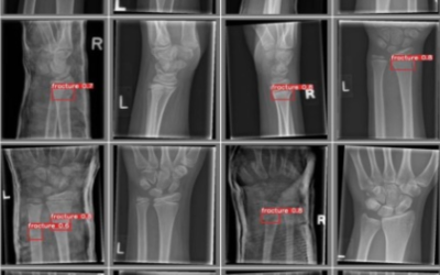 AI in Healthcare – Kids Give Thumbs Up