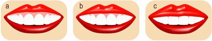 Exploring the Predictability of Invisalign’s SmileView Tool