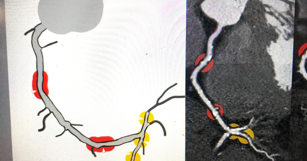 AI Revolutionizes Cardiology Practice for Better Patient Care