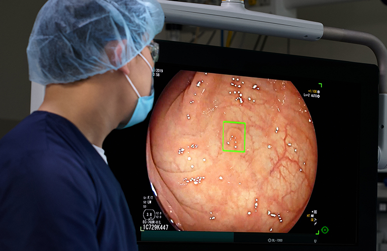 AI in Healthcare – Lessons from Cosmo’s GI Genius Development