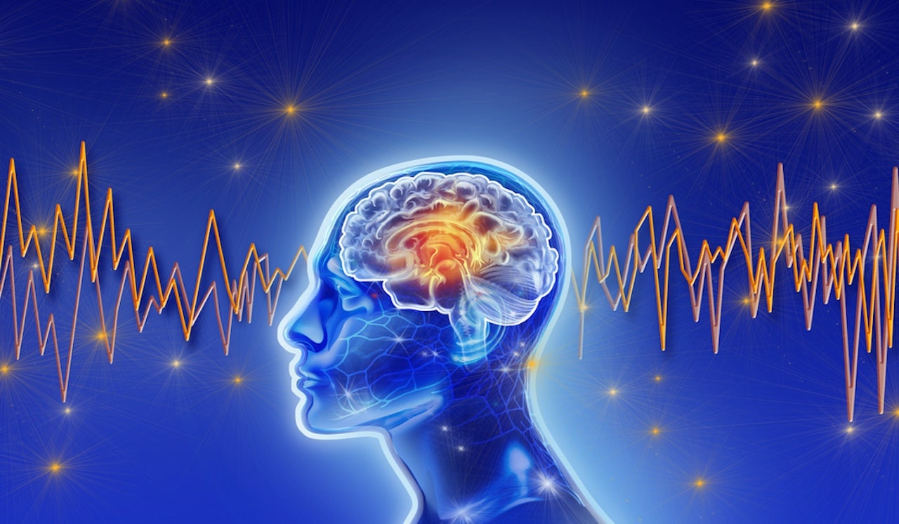 AI-Powered EEGs – A Game-Changer for Early Dementia Detection