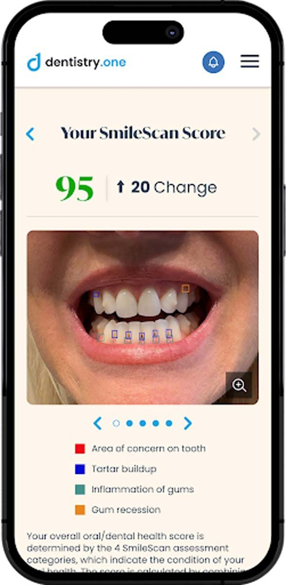 Revolutionizing Oral Care – Dentistry.One Launches SmileScan AI Tool
