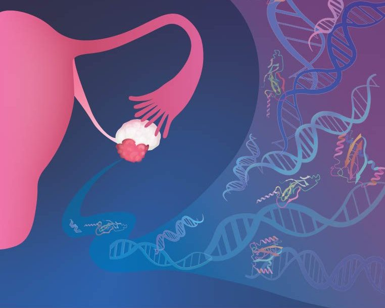 Revolutionary Blood Test Offers Hope for Early Ovarian Cancer Detection