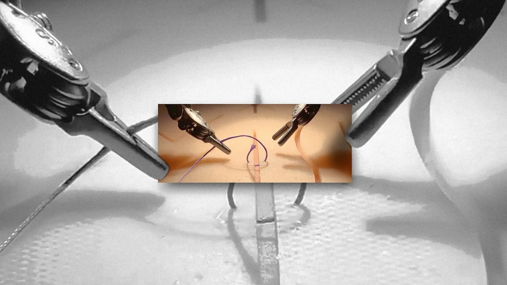 The Future of Surgery – AI Robots Ready to Assist Surgeons