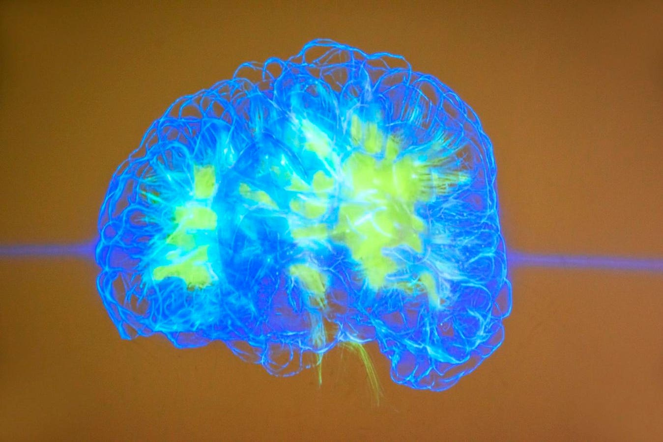 Revolutionizing AI – Baby Dragon Hatchling Learns Like a Human Brain