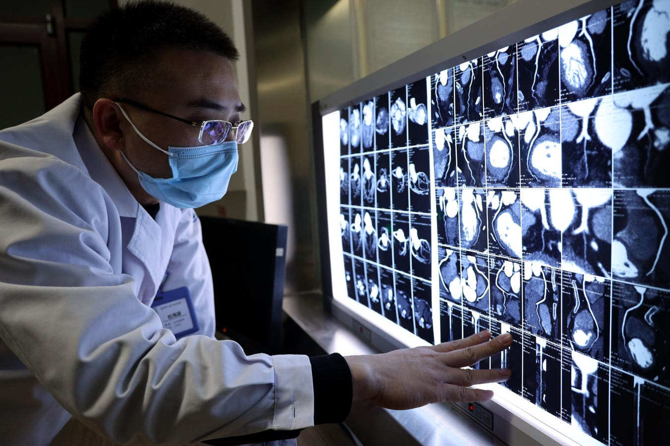 The Limits of AI – Why Human Radiologists Still Matter