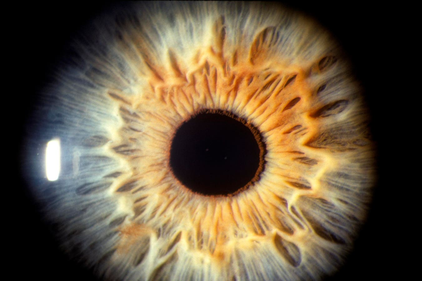 A New Era of Eye Care – How AI is Revolutionizing Oculomics